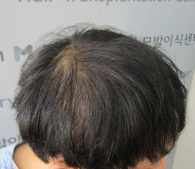 시술전2.JPG
