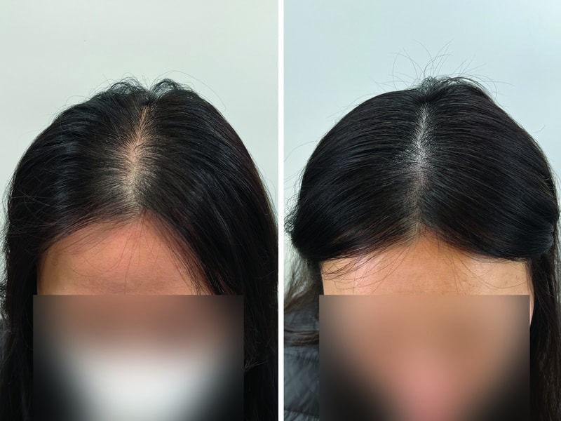 리터치2.jpg
