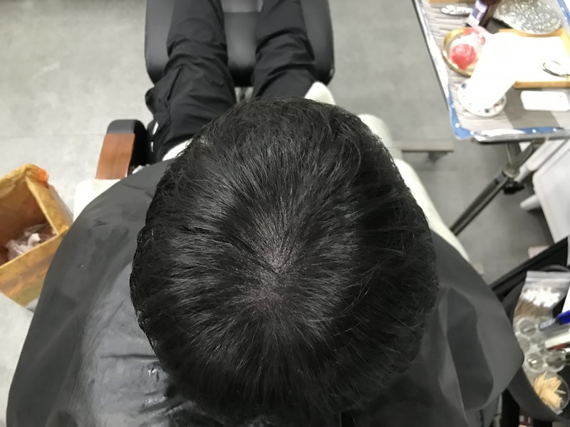 시술후.jpg