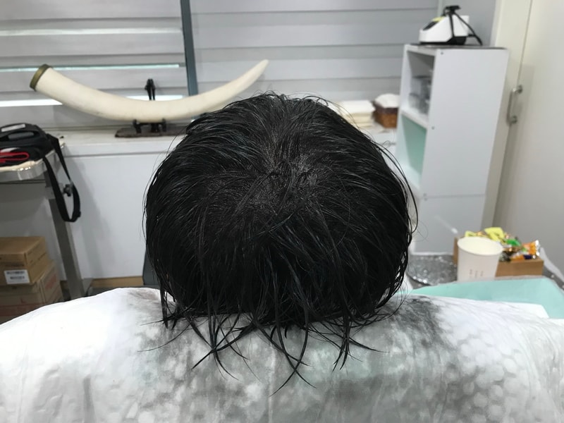 후1.jpg