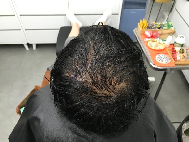 시술전 젖은머리.jpg