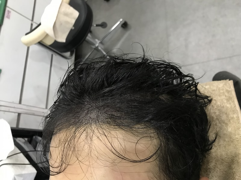 후2.jpg