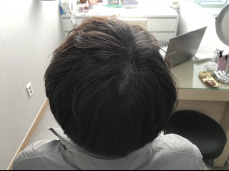 1년차 2.jpg