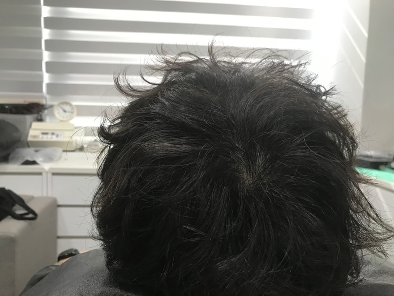 시술전2병원측제공.jpg