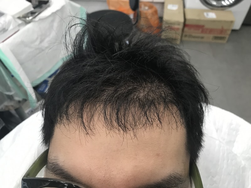문신 전.jpg