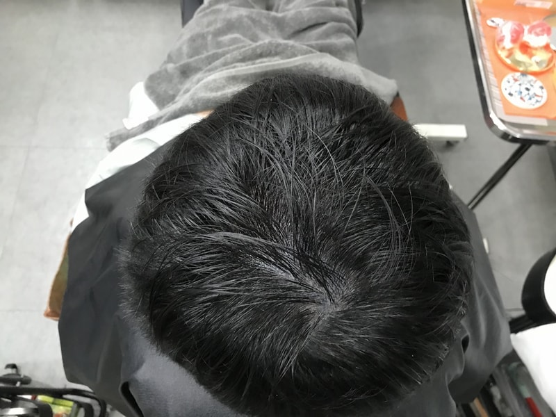 리터치전.jpg