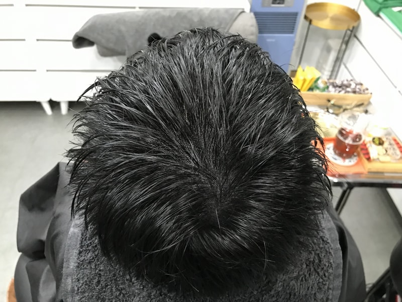 시술후_젖은머리.jpg