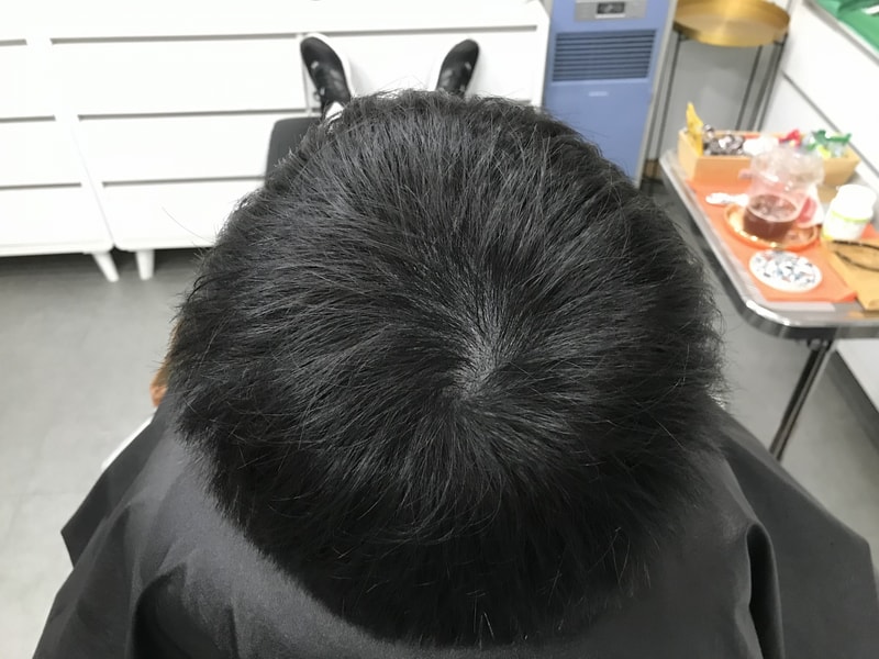 리터치후2.jpg