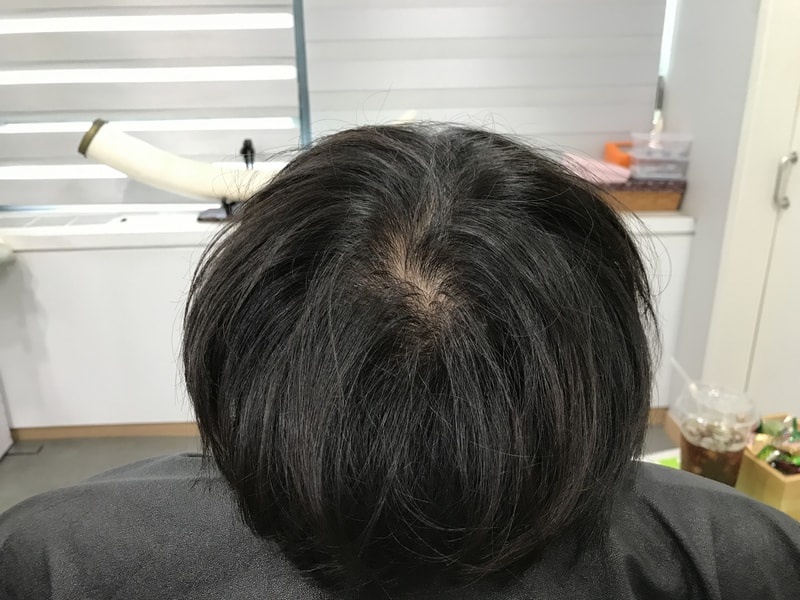 시술전1.jpg
