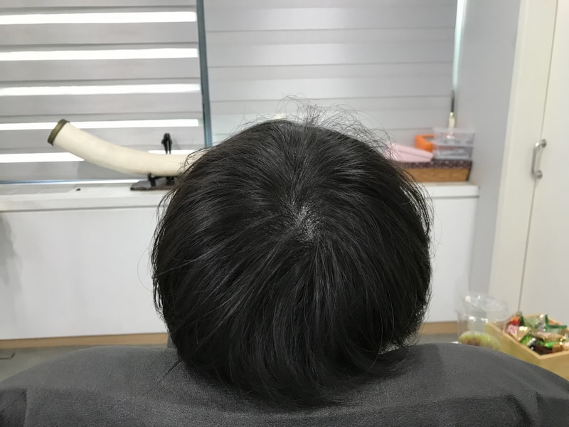 시술후1.jpg