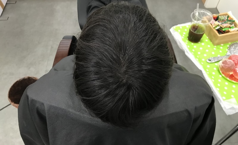 시술후2.1.jpg