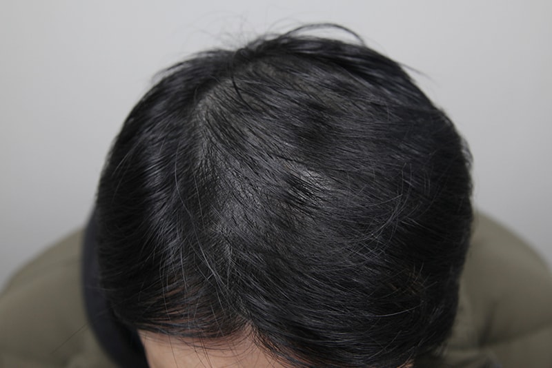 둠피 2.jpg