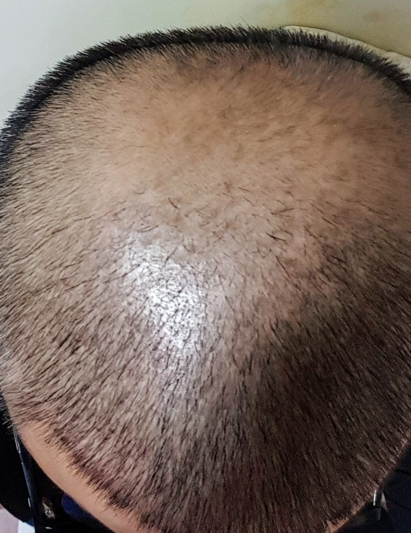 20171214_190844~2.jpg