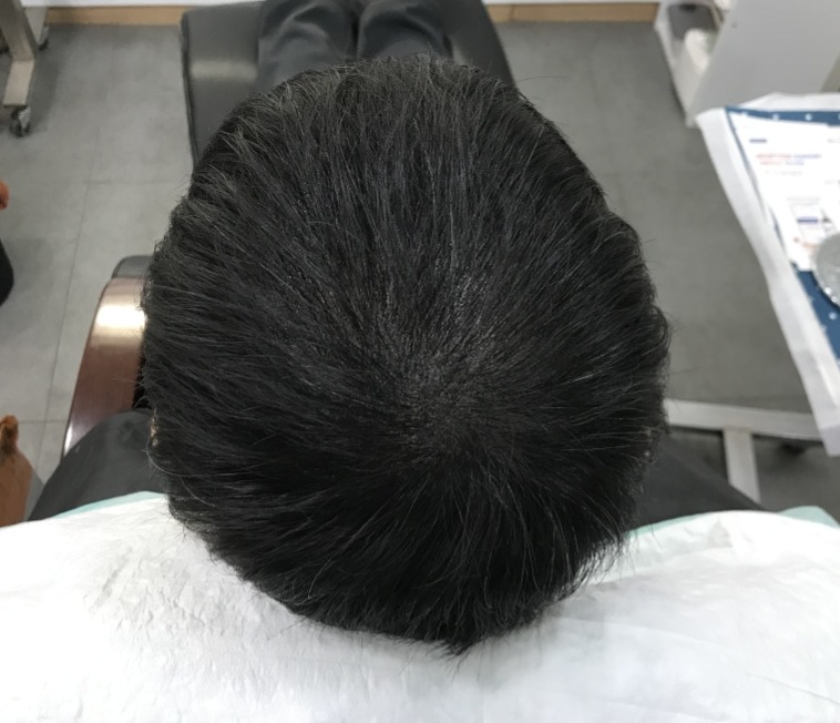 리터치후2.JPG