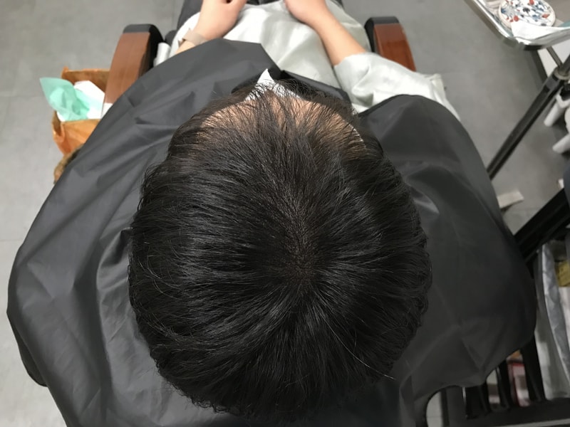 시술후 3.jpg