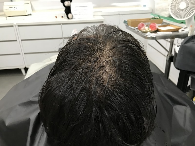 시술전 3.jpg