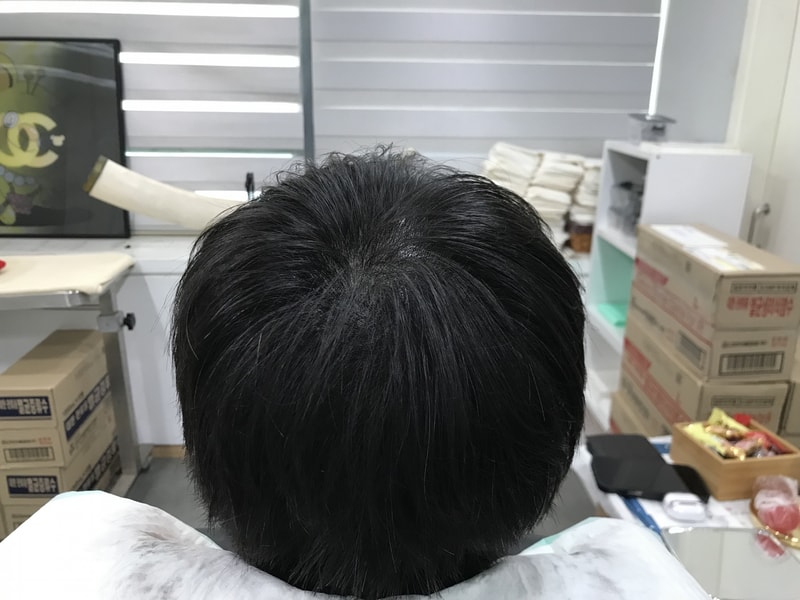 후.jpg