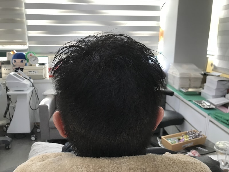 후.jpg