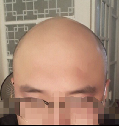 수.png