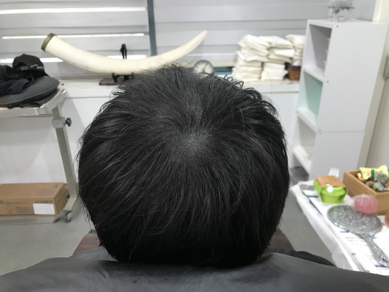 보강후.jpg