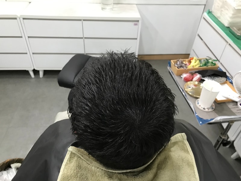 두피문신 시술 후 젖은머리2.jpg