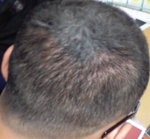 20150617_203450.jpg
