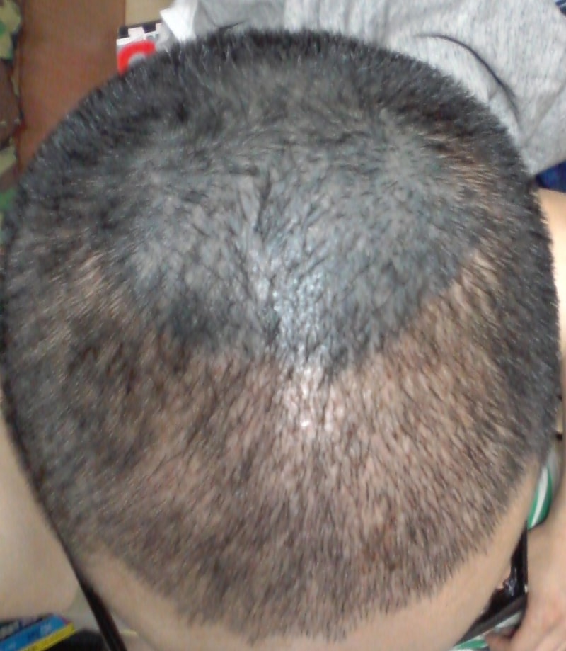 1 20150617_203116.jpg