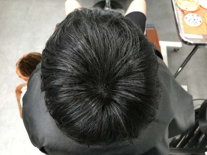 후1.jpg