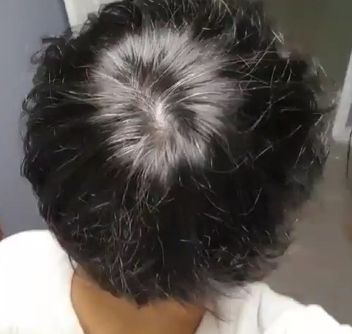 리터치 후 1.jpg
