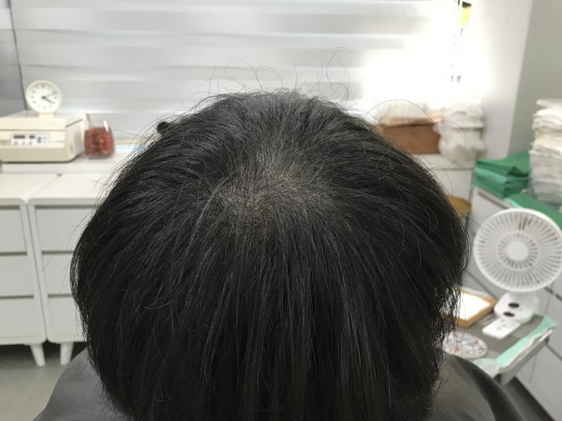 후2.jpg