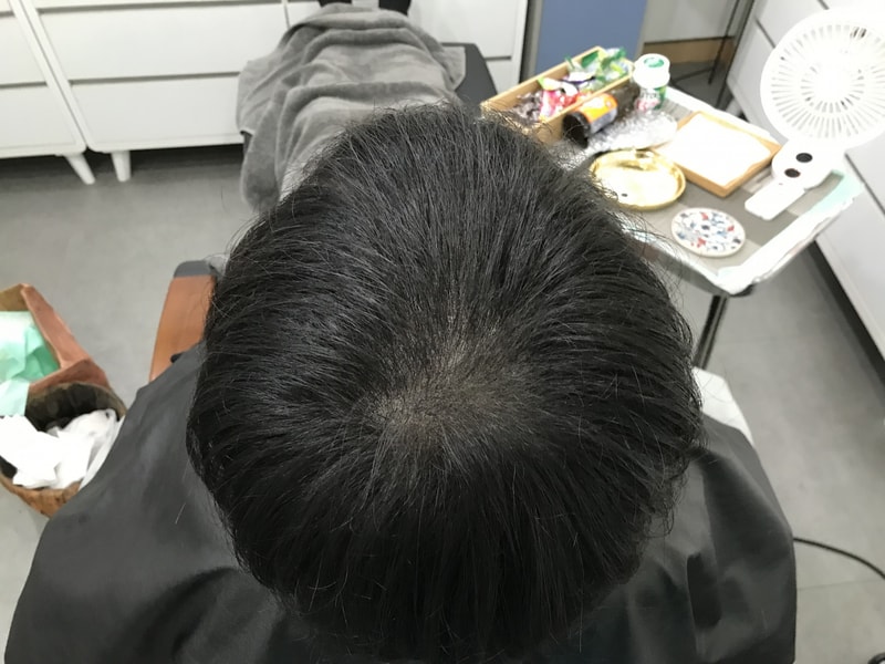 후1.jpg