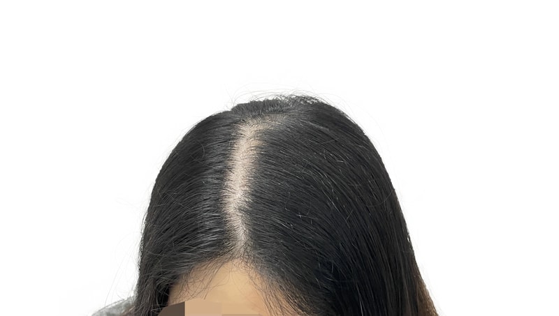 한희 앞머리 전.png