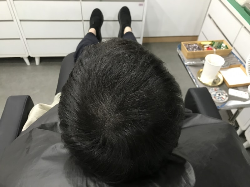 시술후_드라이2.jpg