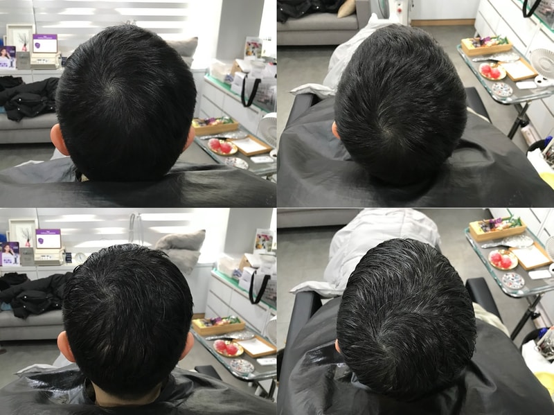 시술전.jpg