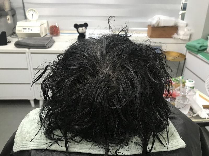 후 젖은.jpg