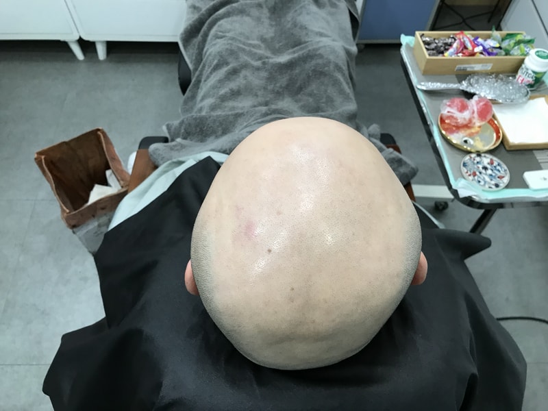 시술전2.jpg