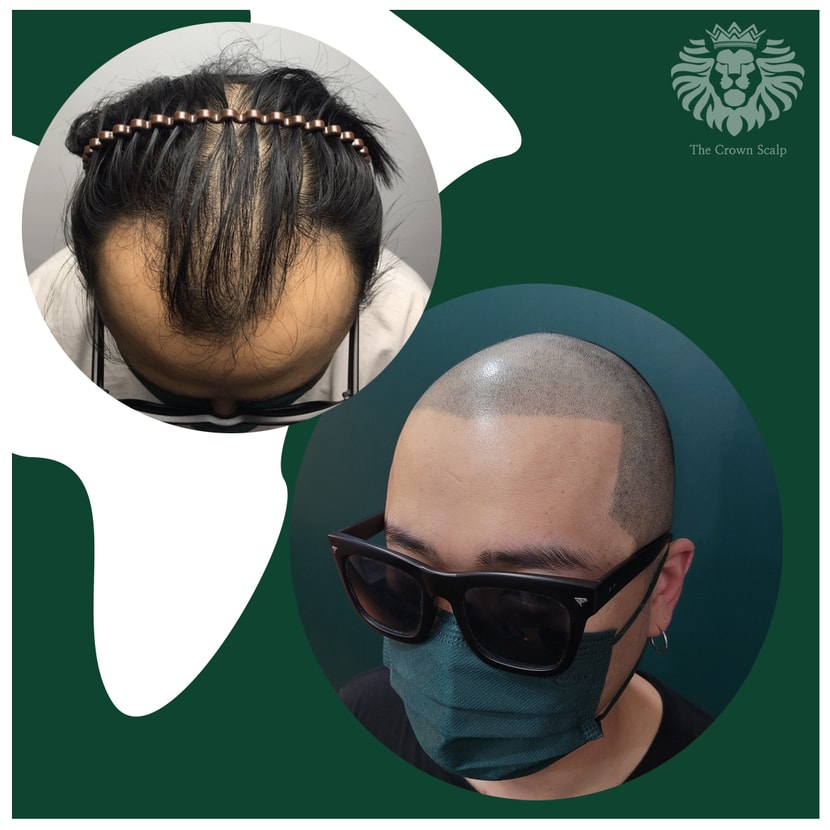 전체삭발문신