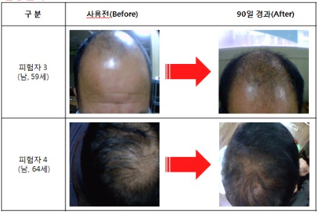 임상실험1