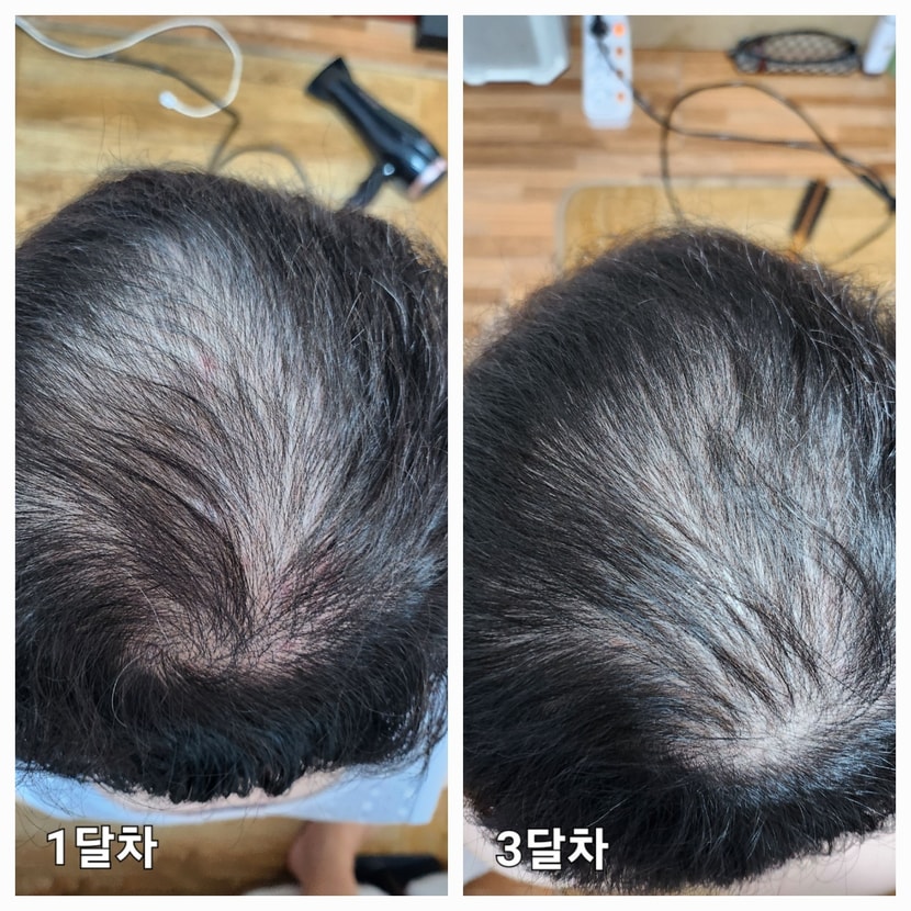1달~3달