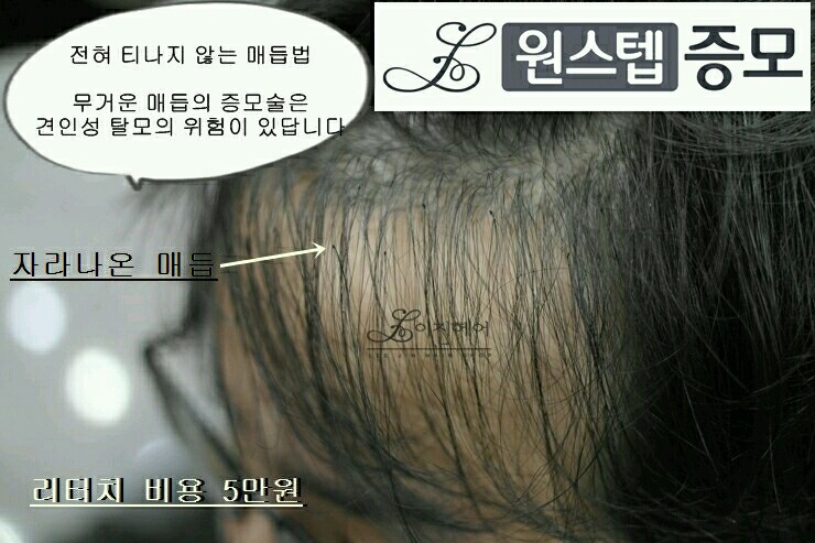 리터치
