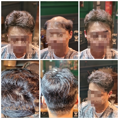 GentleMO # 앞머리를 살린 헤어스타일 / 고정형부착