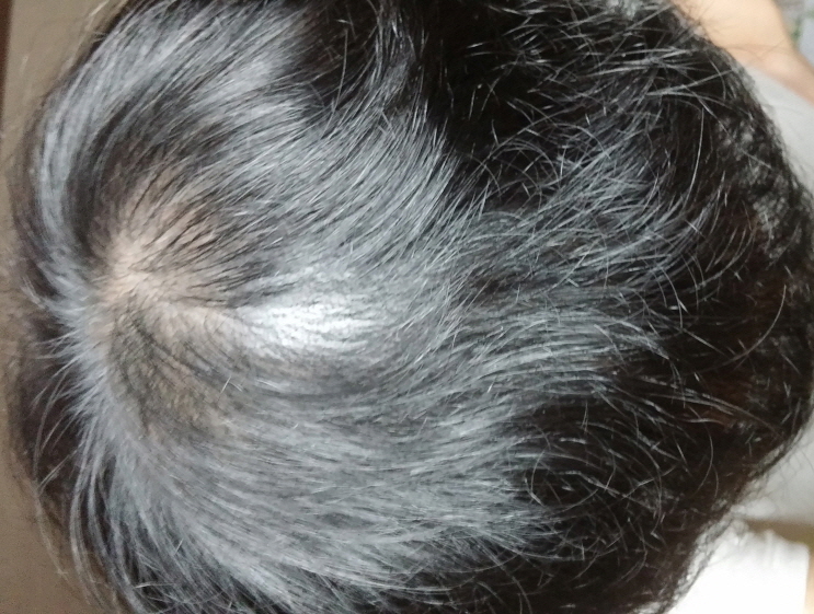 사본 -크기변환_20151126_163445.jpg