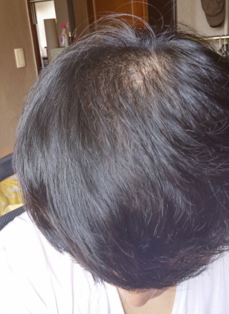 사본 -20150804_155155_HDR.jpg