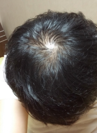사본 -20150804_030800.jpg