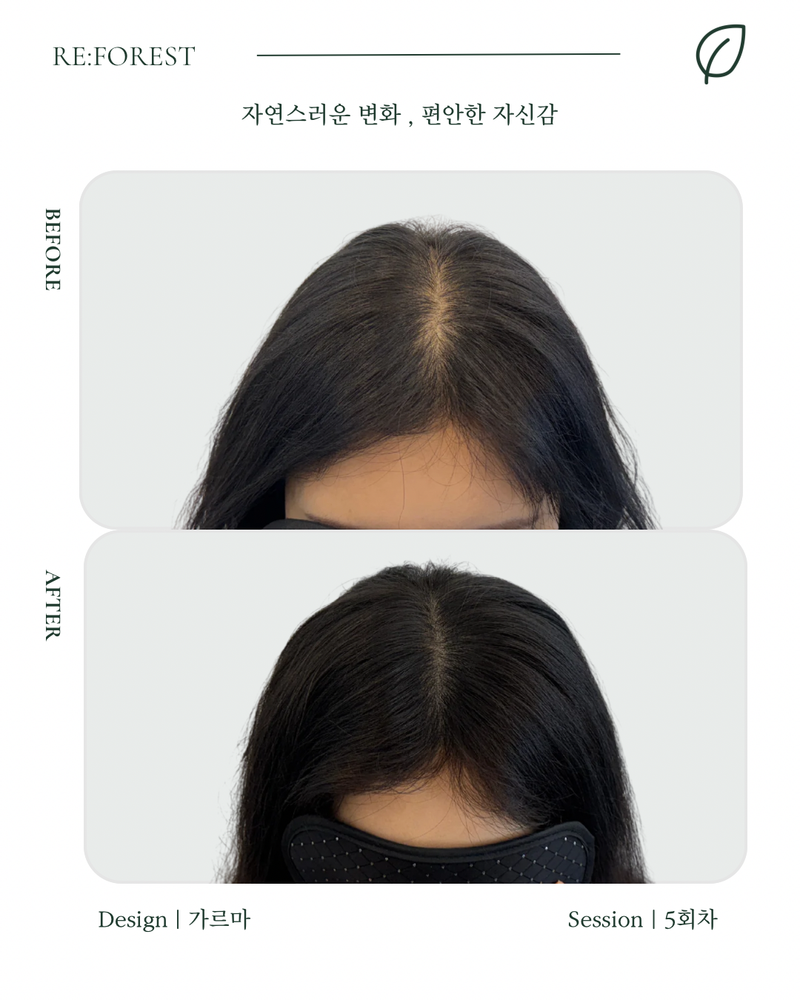 [ 대구 두피문신 포트폴리오 모델 선착순 모집 ]