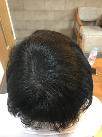 후