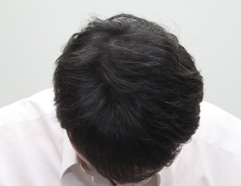 SMP-after1.JPG