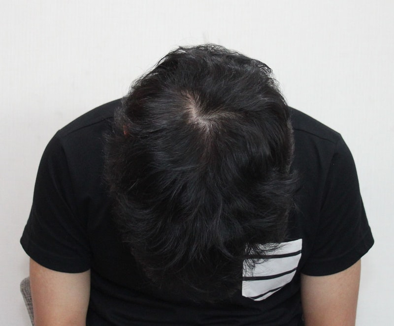 수술전.JPG