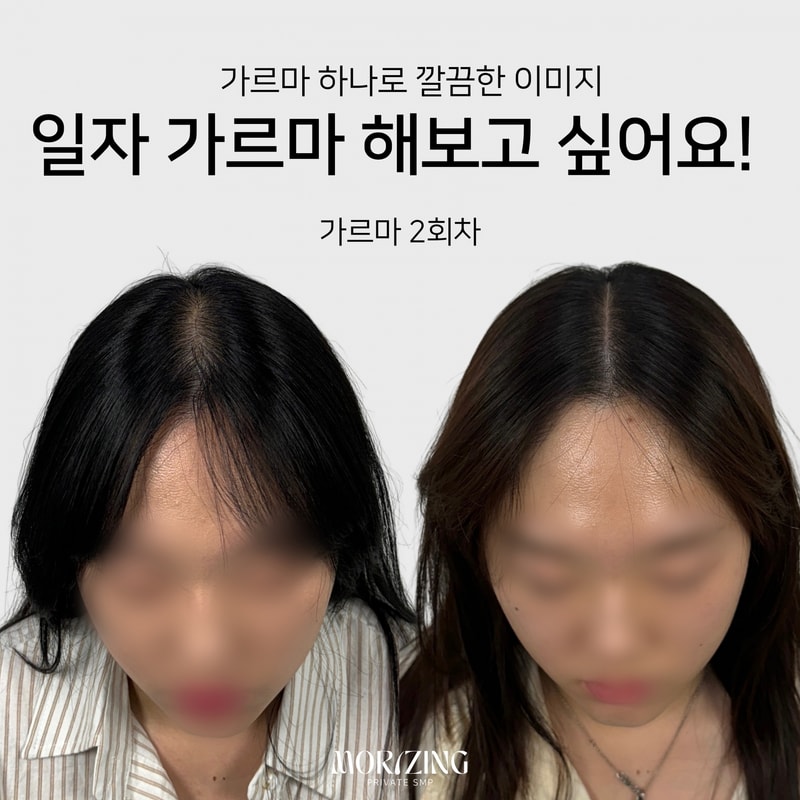 Beige and Blue Minimalist Beauty Skincare Before After Collage Instagram Post의 사본.png