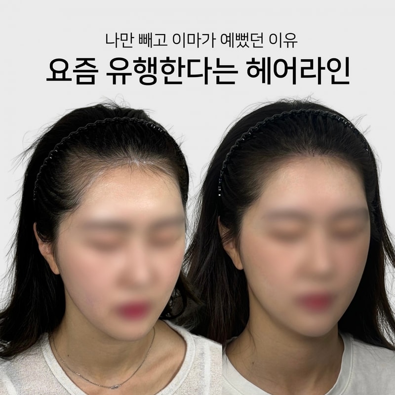 Beige and Blue Minimalist Beauty Skincare Before After Collage Instagram Post의 사본.png